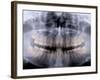 Panoramic X-Ray of Mouth-null-Framed Photographic Print