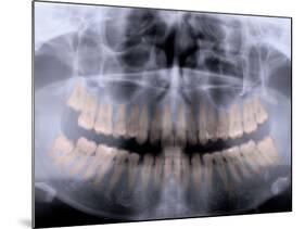 Panoramic X-Ray of Mouth-null-Mounted Photographic Print