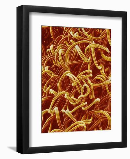 Panty Hose-Micro Discovery-Framed Premium Photographic Print