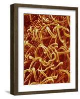 Panty Hose-Micro Discovery-Framed Photographic Print