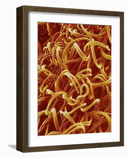 Panty Hose-Micro Discovery-Framed Photographic Print