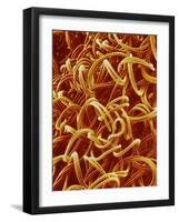 Panty Hose-Micro Discovery-Framed Photographic Print