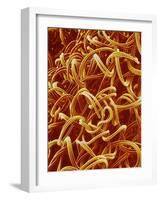 Panty Hose-Micro Discovery-Framed Photographic Print