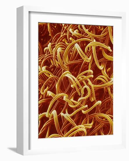 Panty Hose-Micro Discovery-Framed Photographic Print