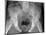 Pelvic Fracture, X-ray-Du Cane Medical-Mounted Photographic Print