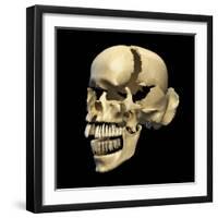 Perspective View of Human Skull-null-Framed Art Print