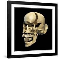 Perspective View of Human Skull-null-Framed Art Print