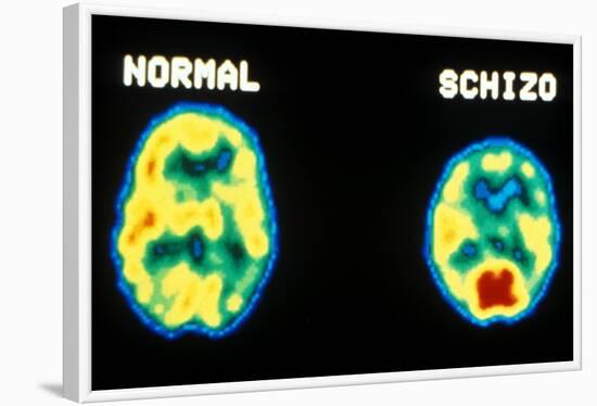 PET scans, normal and schizophrenic-Science Source-Framed Giclee Print