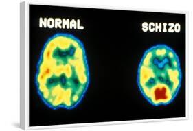 PET scans, normal and schizophrenic-Science Source-Framed Giclee Print