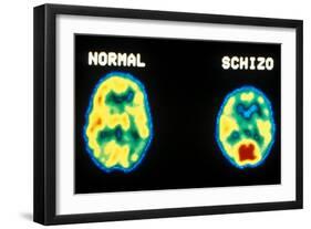 PET scans, normal and schizophrenic-Science Source-Framed Giclee Print