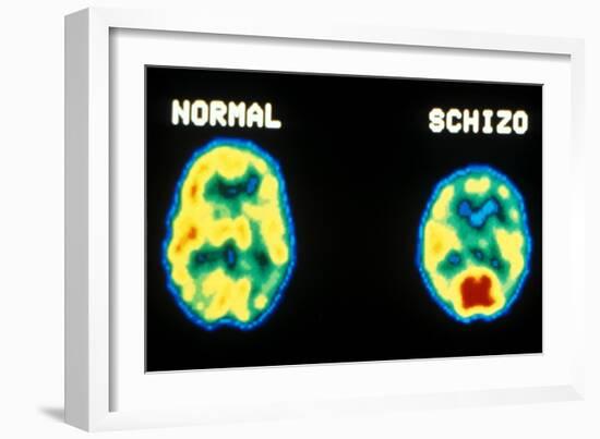 PET scans, normal and schizophrenic-Science Source-Framed Giclee Print