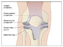 Knee Joint Anatomy, Artwork-Peter Gardiner-Photographic Print
