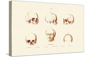 Phrenology, 1833-39-null-Stretched Canvas