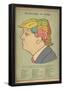 Phrenology Of Trump-null-Framed Poster