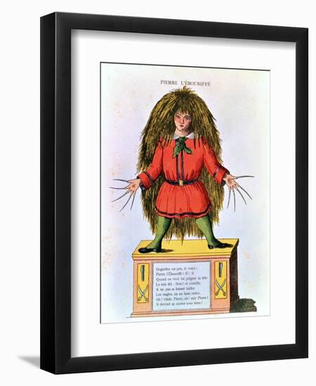 "Pierre L'Ebouriffe," Illustration from the French Translation of Hoffmann's "Struwwelpeter"-Heinrich Hoffmann-Framed Giclee Print