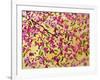 Pink Blossoms and Yellow Sky II-Patty Baker-Framed Art Print