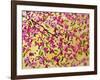 Pink Blossoms and Yellow Sky II-Patty Baker-Framed Art Print