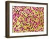 Pink Blossoms and Yellow Sky II-Patty Baker-Framed Art Print