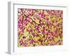 Pink Blossoms and Yellow Sky II-Patty Baker-Framed Art Print