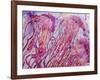 Pink Jellyfish-Lauren Moss-Framed Giclee Print