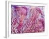 Pink Jellyfish-Lauren Moss-Framed Giclee Print