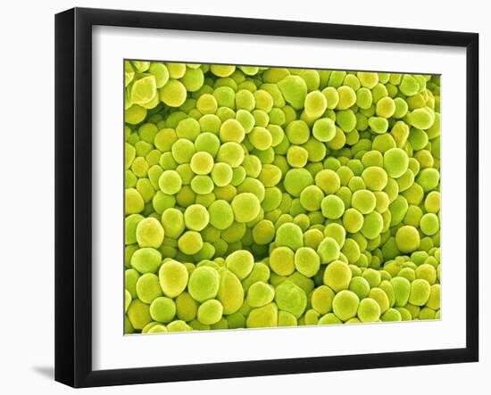 Pistil of Buttercup-Micro Discovery-Framed Photographic Print