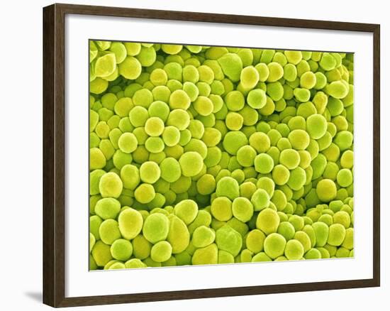 Pistil of Buttercup-Micro Discovery-Framed Photographic Print