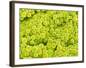 Pistil of Buttercup-Micro Discovery-Framed Photographic Print
