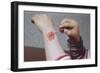 Placing Medicine on Infection-William P. Gottlieb-Framed Photographic Print