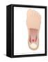 Plantar Fasciitis, Artwork-Peter Gardiner-Framed Stretched Canvas