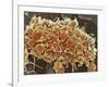 Platelets In a Blood Clot-Steve Gschmeissner-Framed Photographic Print