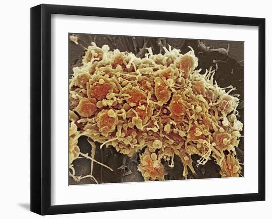 Platelets In a Blood Clot-Steve Gschmeissner-Framed Photographic Print