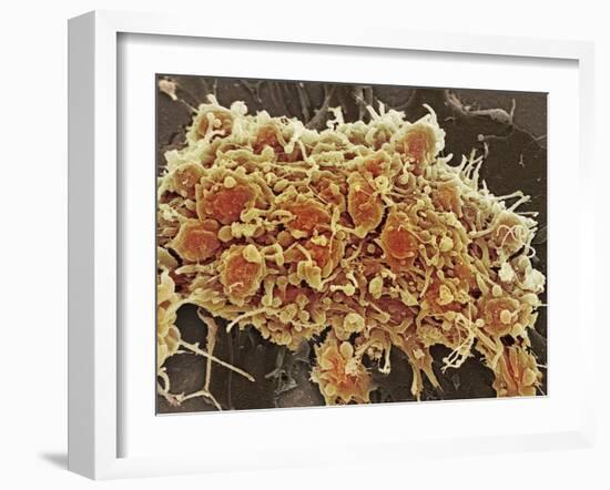 Platelets In a Blood Clot-Steve Gschmeissner-Framed Photographic Print