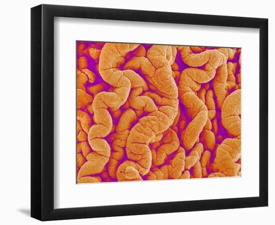 Pleat on Interior of Oviduct of a Rabbit-Micro Discovery-Framed Photographic Print