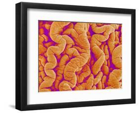 Pleat on Interior of Oviduct of a Rabbit-Micro Discovery-Framed Photographic Print