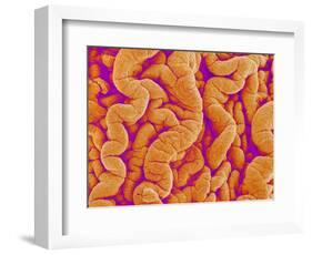 Pleat on Interior of Oviduct of a Rabbit-Micro Discovery-Framed Photographic Print