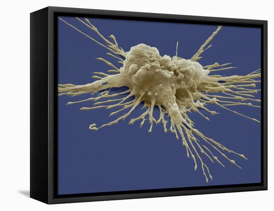 Pluripotent Stem Cell, SEM-Steve Gschmeissner-Framed Stretched Canvas