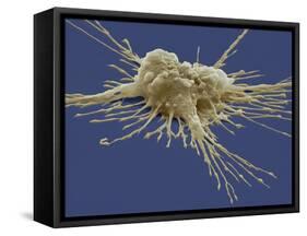 Pluripotent Stem Cell, SEM-Steve Gschmeissner-Framed Stretched Canvas