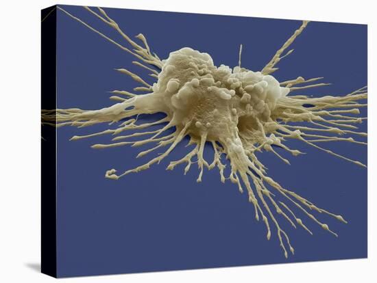 Pluripotent Stem Cell, SEM-Steve Gschmeissner-Stretched Canvas