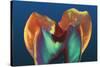 Polarised LM of a Molar Tooth Showing Decay-Volker Steger-Stretched Canvas