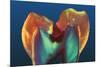 Polarised LM of a Molar Tooth Showing Decay-Volker Steger-Mounted Photographic Print