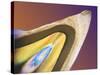 Polarised LM of a Tooth with a Dental Crown-Volker Steger-Stretched Canvas