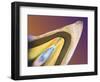 Polarised LM of a Tooth with a Dental Crown-Volker Steger-Framed Premium Photographic Print