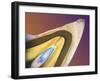 Polarised LM of a Tooth with a Dental Crown-Volker Steger-Framed Photographic Print