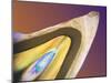Polarised LM of a Tooth with a Dental Crown-Volker Steger-Mounted Photographic Print