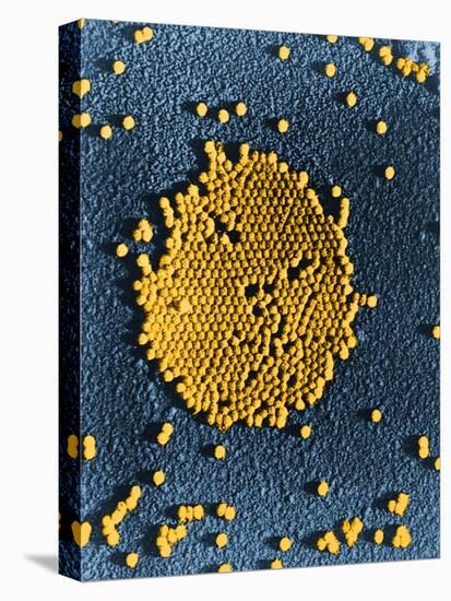 Poliovirus, TEM-Science Source-Stretched Canvas