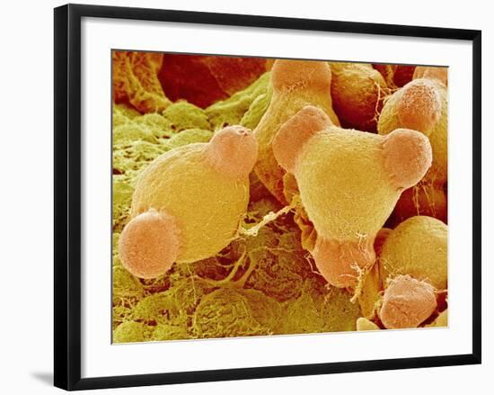 Pollen of Evening Primrose-Micro Discovery-Framed Photographic Print