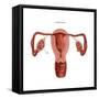 Polycystic Ovaries-Gwen Shockey-Framed Stretched Canvas