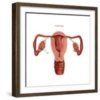 Polycystic Ovaries-Gwen Shockey-Framed Art Print