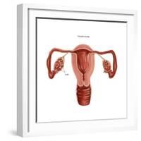 Polycystic Ovaries-Gwen Shockey-Framed Art Print